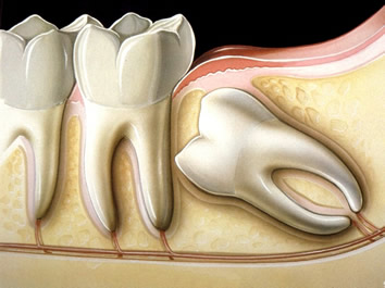 Cirurgia Odontólogica