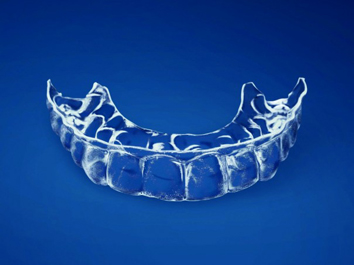 Essix Clear Aligner