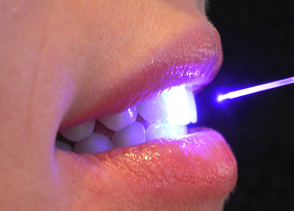Laser