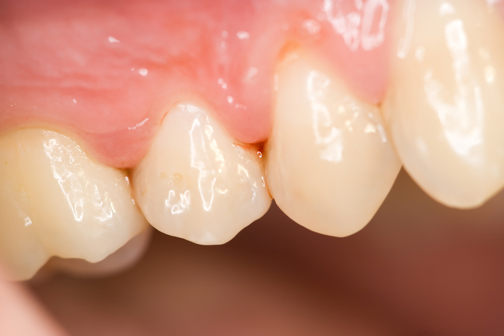 Periodontia